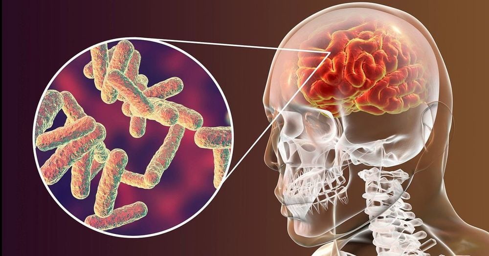 Đau đầu kéo dài, người đàn ông 51 tuổi bàng hoàng phát hiện ký sinh trùng "ăn" khắp não-ongkinh