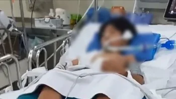 Bị nhánh cây rơi trúng đầu, bé trai 10 tuổi ở TP.HCM nguy kịch-ongkinh