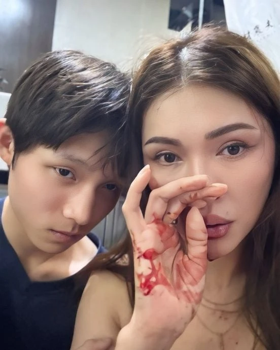 Siêu mẫu Amber Chia nhập viện khẩn cấp, mặt đầy máu khiến fan "đứng tim" - Techlade