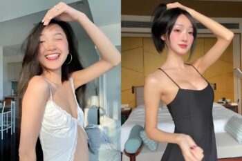 TikToker đau đớn mất 1,3 triệu follow vì nâng ngực-ongkinh