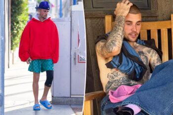 Ngoại hình gầy gò của Justin Bieber khiến người hâm mộ lo ngại - Ongkinh