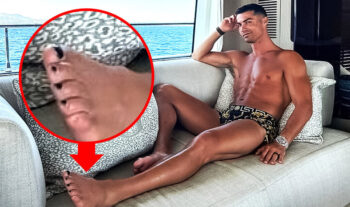 Siêu sao Cristiano Ronaldo và bí mật bộ móng chân sơn đen-ongkinh