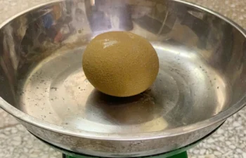 Lấy sỏi bàng quang lớn bằng quả cam từ người đàn ông 69 tuổi-ongkinh