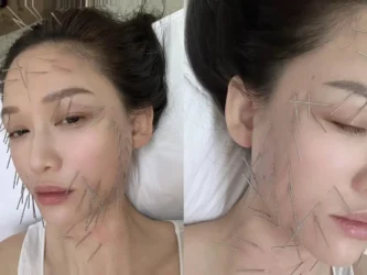 Phương pháp làm đẹp gây tranh cãi của Trần Kiều Ân - Ongkinh