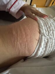 Phương Mỹ Chi nguy kịch, bác sĩ bất lực trước tình trạng hiếm gặp