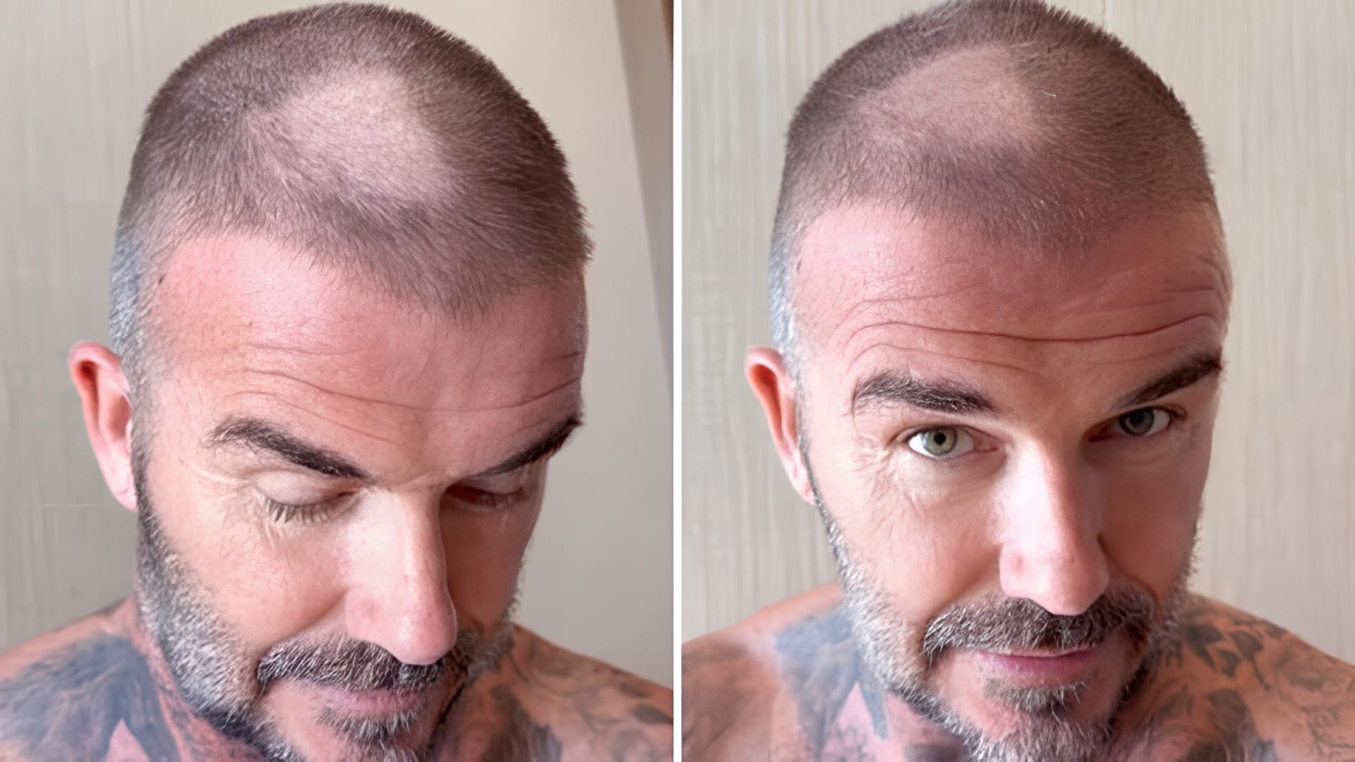 David Beckham gặp sự cố hài hước khi tự cạo đầu-ongkinh