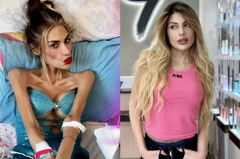 Nihal Candan qua đời ở tuổi 30 vì chứng biếng ăn: Giảm gần 40 kg trong 2 năm - Ongkinh