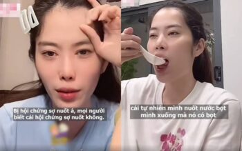 Nam Em tiết lộ cô mắc chứng sợ nuốt