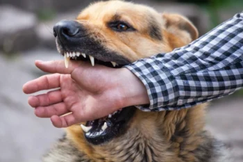 Một người đàn ông tại Đắk Lắk không qua khỏi vì bệnh dại do chủ quan không tiêm phòng-ongkih