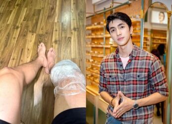 Phiên bản báo chí trung lập: Nam diễn viên VFC gặp biến chứng sau 1 năm đứt dây chằng chéo trước, tình trạng sức khỏe đáng lo ngại
