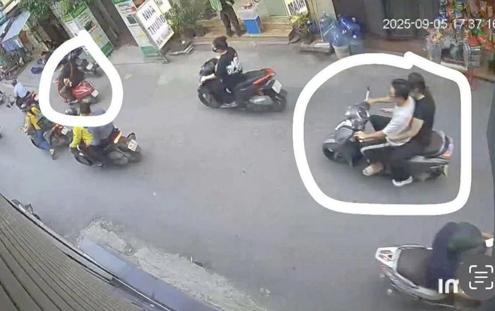 Nam sinh viên bị đánh gãy xương hàm giữa phố vì bị cho là "nhìn đểu" - ongkinh