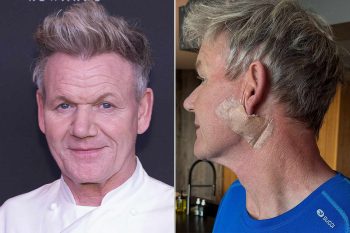 Đầu bếp Gordon Ramsay bị ung thư