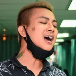 Hoài Lâm xóa hình xăm-ongkinh